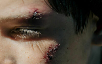 Gunshot Wounds, Knife Wounds, and Blunt Trauma Presentation