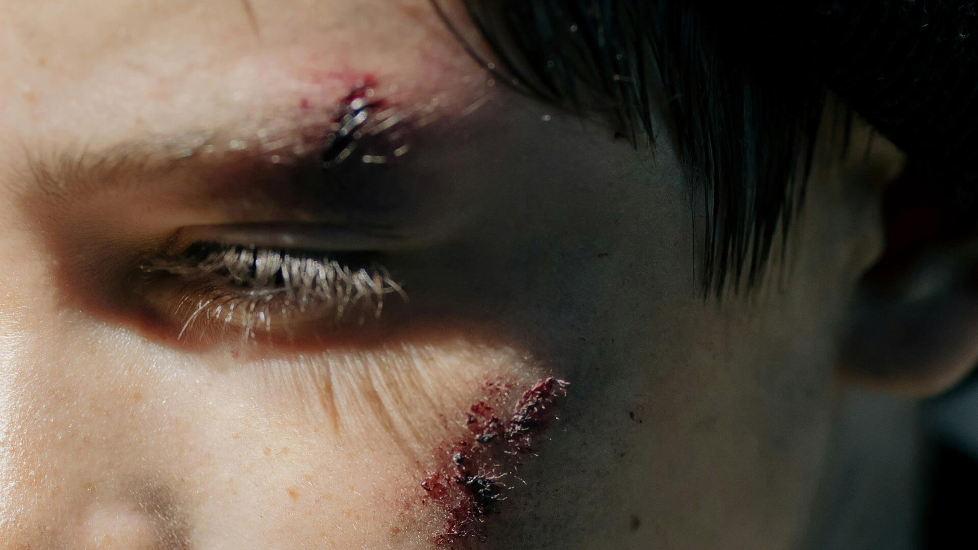Gunshot Wounds, Knife Wounds, and Blunt Trauma Presentation